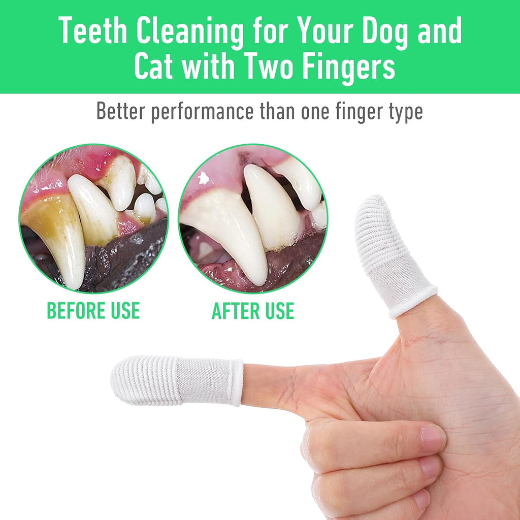 YUIANLB 40 Pcs Pet Dental Care Kit Finger Toothbrush Oral Cleaning Wipes