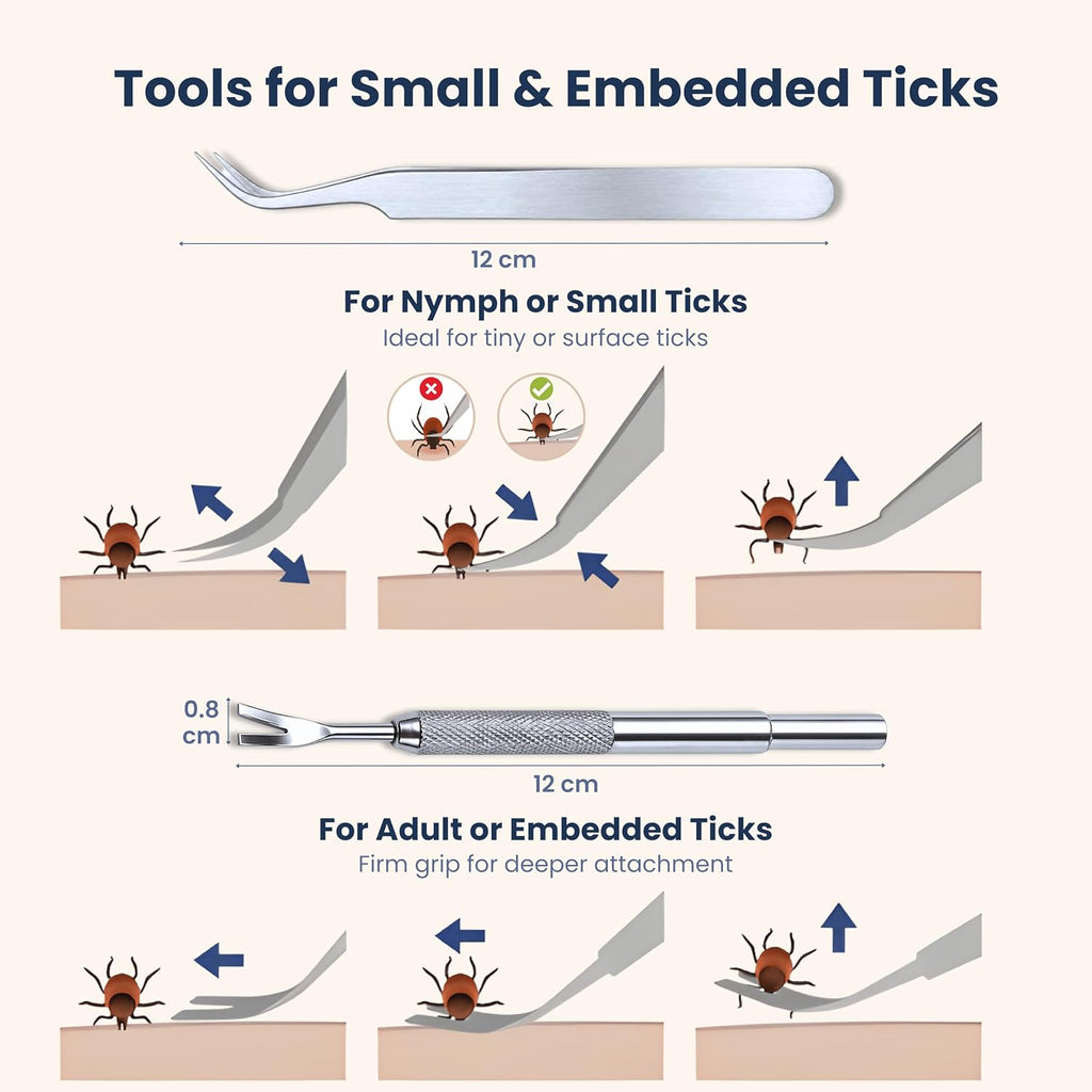 Complete Tick Removal Kit for Dogs & Cats – Tick Remover Tool Set with 3 Size Hooks, Tick Comb & Stainless Steel Precision Tick Remover + Tweezers, Travel Pouch – Safe, Fast Tick Removal