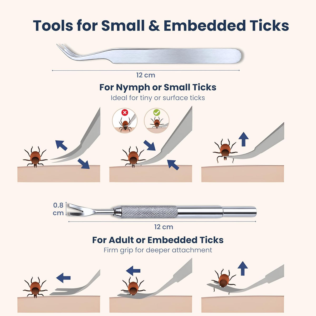 Complete Tick Removal Kit for Dogs & Cats – Tick Remover Tool Set with 3 Size Hooks, Tick Comb & Stainless Steel Precision Tick Remover + Tweezers, Travel Pouch – Safe, Fast Tick Removal