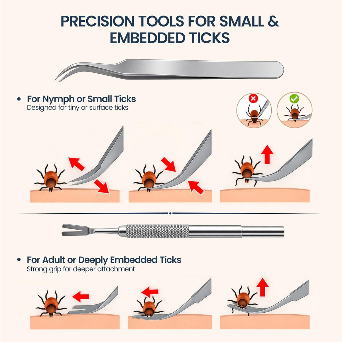 Complete Tick Removal Kit for Dogs & Cats – Tick Remover Tool Set with 3 Size Hooks, Tick Comb & Stainless Steel Precision Tick Remover + Tweezers, Travel Pouch – Safe, Fast Tick Removal
