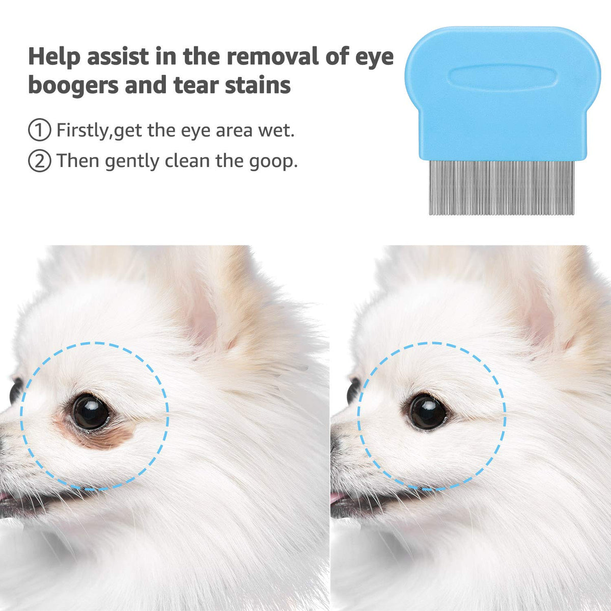 Flea Comb For Dogs & Cats Pet Comb Grooming Set 5 Pieces Metal Teeth Durable Remove Tear Stain Float Hair Combing tangled hair Dandruff Add Storage Pouch (Blue)