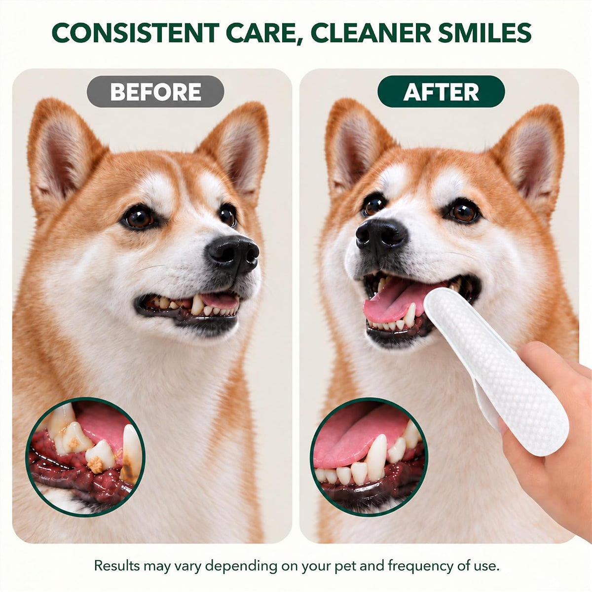 Extra-Long Dental Finger Wipes with Split Opening